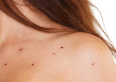 Freckle hearts am Schlüsselbein