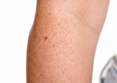 Freckle heart tattoo