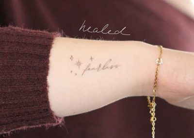 Verheilter Schriftzug