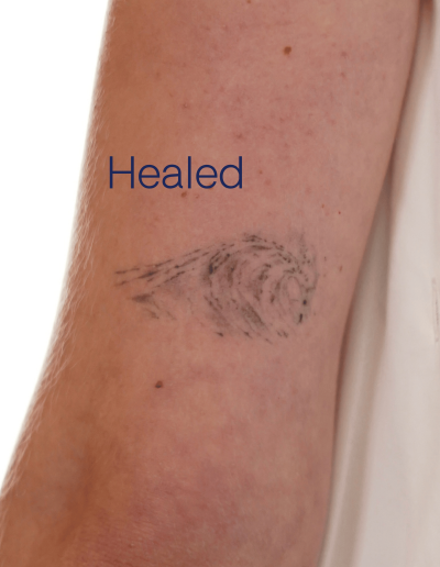 Verheiltes Wellen-Tattoo
