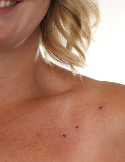 Freckle hearts am Schlüsselbein